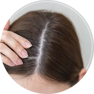 Itchy scalp from trichophyton