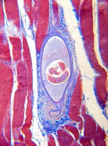 Trichinella spiralis in animal muscle, under a microscope